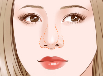 湖州超聲波去眼袋整形美容醫(yī)院排名揭曉！2023年比較推崇的湖州去眼袋醫(yī)院前十強(qiáng)+綜合口碑