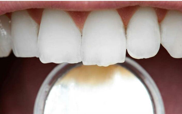 2023年哪家醫(yī)院在鎮(zhèn)江做水動(dòng)力抽脂瘦腰效果比較好？TOP10整形醫(yī)院發(fā)布！