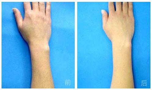 杭州哪家整形美容醫(yī)院能有效避免眼部皺紋？2023年杭州眼部皺紋美容醫(yī)院前十位排行榜來啦！