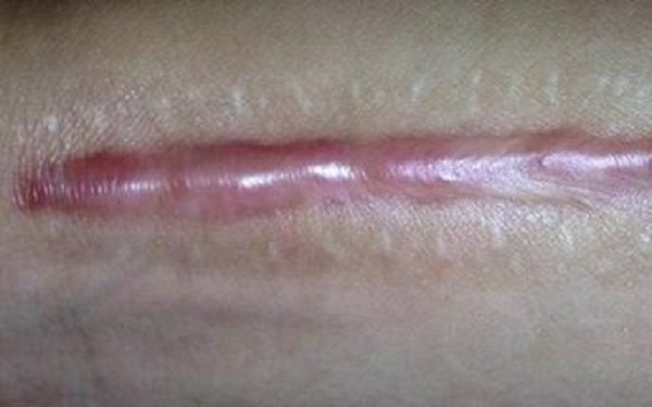 2023蘇州面部皺紋填充醫(yī)院排名揭曉！哪家醫(yī)院在皺紋填充領(lǐng)域名列前茅？