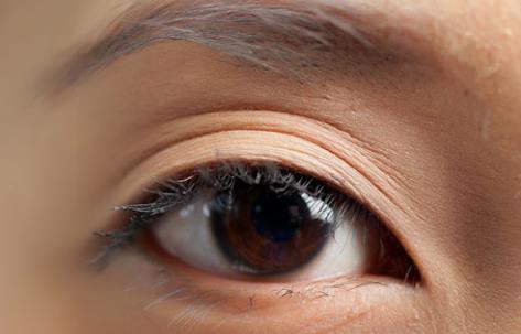 2023年?yáng)|莞納晶祛痘坑魅力醫(yī)美院值得選擇的十大佼佼者！