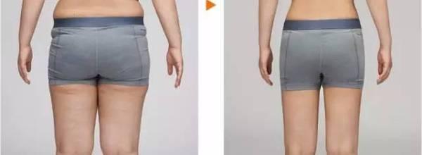 2023年北京妊娠紋整形美容機(jī)構(gòu)排名前10，哪家權(quán)威可靠？