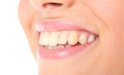 2023杭州口周紋整形醫(yī)院口碑好的有哪些？杭州物理去口周紋醫(yī)院排名揭曉！