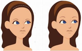 四川哪家醫(yī)院點陣激光去痘印口碑更佳？2023年四川點陣激光去痘印醫(yī)療整形醫(yī)院前十強榜單發(fā)布！