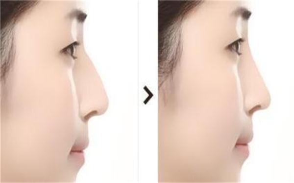 2023年中回顧！阜陽注射祛疤痕領(lǐng)域權(quán)威整形美容醫(yī)院排行榜TOP10強(qiáng)揭曉！