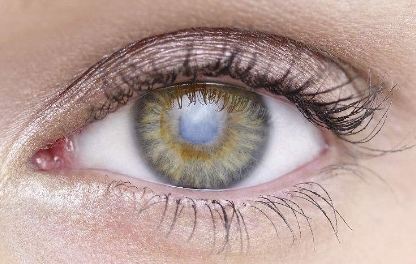 首家公開評(píng)選！2023年新鄉(xiāng)市值得信賴的鼻孔整形醫(yī)院排行榜大揭曉！