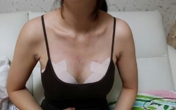 2023年北京注射脂肪隆胸醫(yī)院排名top10，讓你不再為選擇糾結(jié)！