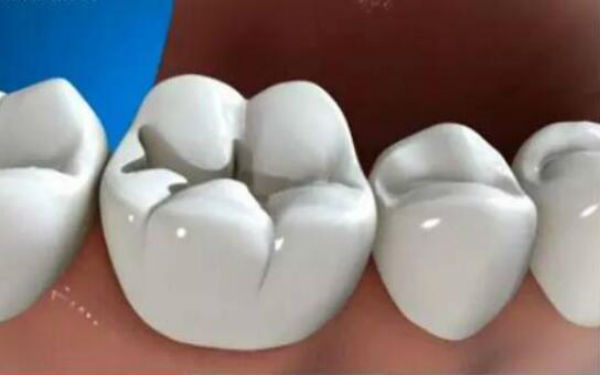 廣州整形醫(yī)療機構(gòu)，磨皮祛疤痕效果顯著，受到廣泛好評！2023年，廣州市百家整形醫(yī)院中，激光磨皮祛疤痕效果