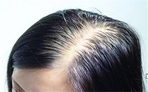 2023年莆田除皺醫(yī)院排行榜前十強(qiáng)，這些醫(yī)院的口碑如何？