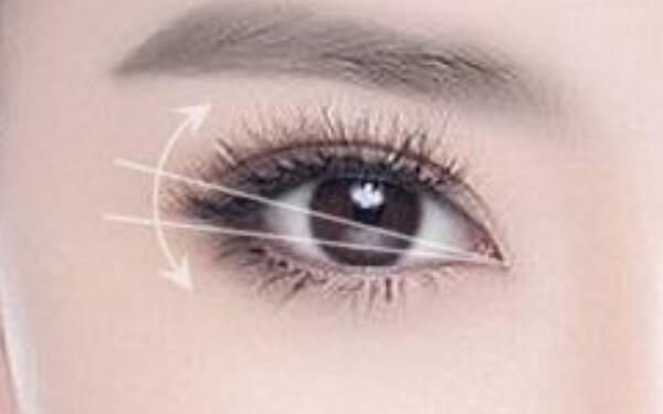 上海哪家醫(yī)院提供專業(yè)光纖溶脂祛魚尾紋服務(wù)？2023最新排名揭曉！