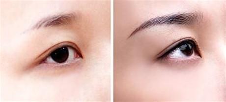 廣州吸脂瘦大臂整形醫(yī)院盤點！2023年強力推薦前10家！