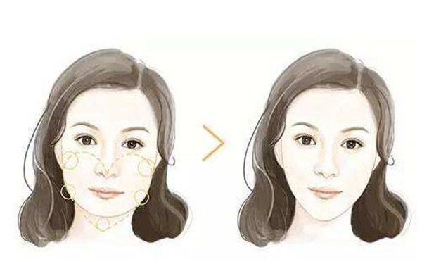 南京哪家整形醫(yī)院能有效去除面部皺紋？2023年南京治療面部皺紋醫(yī)院排名前10強(qiáng)！