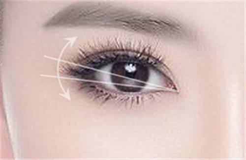 2023年茂名哪家醫(yī)院治療眼紋效果好？排名前10值得參考！