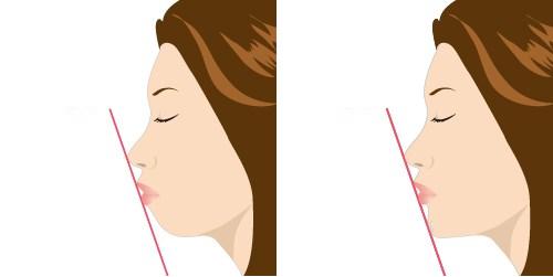 2023鄭州哪家口碑不錯的切開填充去痘疤整形美容醫(yī)院排行榜發(fā)布，前10強揭曉！