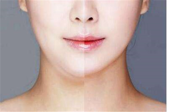 南京哪里可以做眉間紋注射填充手術(shù)？2023年南京眉間紋注射填充醫(yī)院實力排行榜發(fā)布！前十家醫(yī)療整形機構(gòu)評測