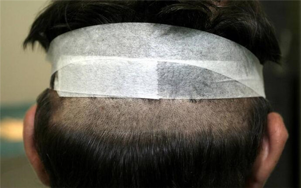 重慶哪家醫(yī)院豐唇口碑好？2023年榜單前十大整形美容醫(yī)院推薦！