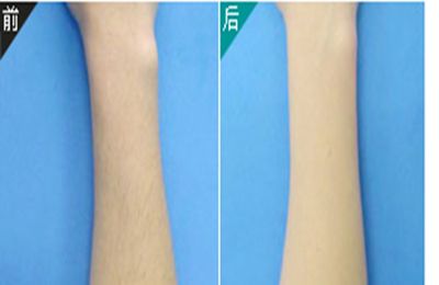 2023年西安陰道緊縮術(shù)修補(bǔ)醫(yī)院推薦TOP10強(qiáng)熱門評(píng)分揭曉！