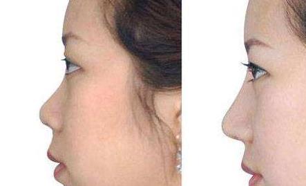 太原哪家醫(yī)院專(zhuān)業(yè)斑點(diǎn)祛老，口碑比較好？2023太原斑點(diǎn)祛老美容醫(yī)院排名TOP10熱門(mén)機(jī)構(gòu)推薦！