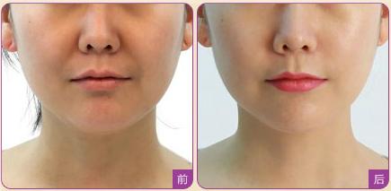 上海眉間紋醫(yī)療整形醫(yī)院強榜前10，選取眉間紋正規(guī)醫(yī)院指南