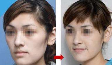 廈門注射膠原蛋白減少川字紋的整形醫(yī)院排名公開！2023廈門膠原蛋白去皺醫(yī)院前10強(qiáng)榜單揭曉！