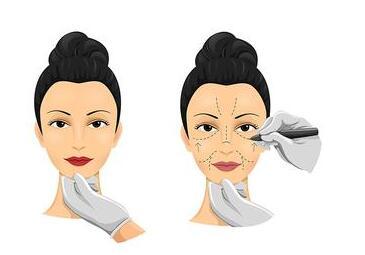 福建哪家整形醫(yī)院專業(yè)除眼皺紋效果好？2023年福建除眼皺紋評分十強(qiáng)醫(yī)院公布！