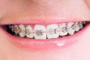 2023石家莊比較推崇的無痕翹睫法雙眼皮整形醫(yī)院最新排行榜來襲！石家莊無痕翹睫法雙眼皮權威專家醫(yī)院排名揭