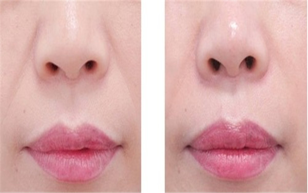 揭秘2023年海南十大專業(yè)除眼紋醫(yī)療美容醫(yī)院，哪些值得考慮！