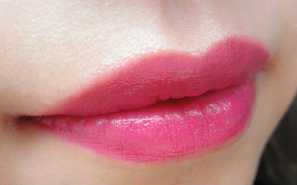 2023上海很受歡迎的射頻吸脂瘦肩部整形醫(yī)院排行榜公布！看看哪些醫(yī)院值得選擇