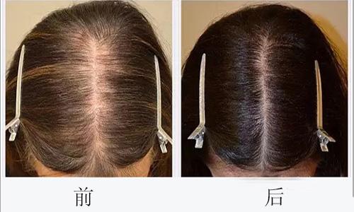 廣州哪些醫(yī)院可靠，專業(yè)進(jìn)行臉部疤痕切除整形美容？2023年十大排名公開！