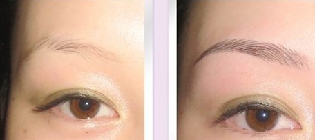 2023年漳州光子嫩膚脫毛正規(guī)醫(yī)療整形醫(yī)院評價TOP10強參考-誰的性價比比較高？