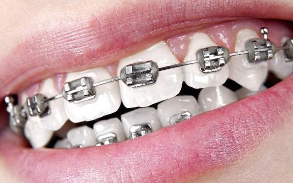 2023年北京微晶祛雀斑美容醫(yī)院排名前十，哪幾家值得去？