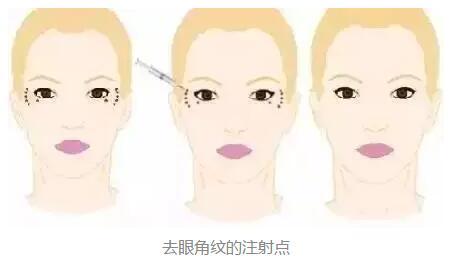 2023年北京鼻端缺損整形美容醫(yī)院前十強(qiáng)排名揭曉！知名度爆棚的醫(yī)療機(jī)構(gòu)盤(pán)點(diǎn)！