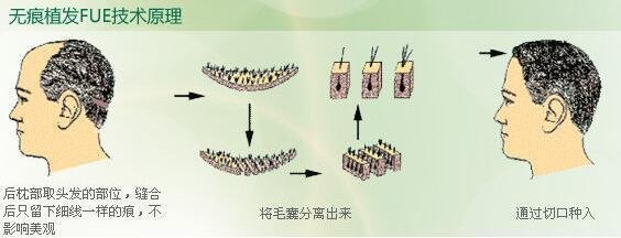 2023青島眼袋修復(fù)手術(shù)排名前10的信譽(yù)醫(yī)院！