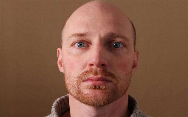 2023年舟山韓式開眼角手術(shù)醫(yī)院推薦，口碑爆棚的前10家醫(yī)院盤點(diǎn)！