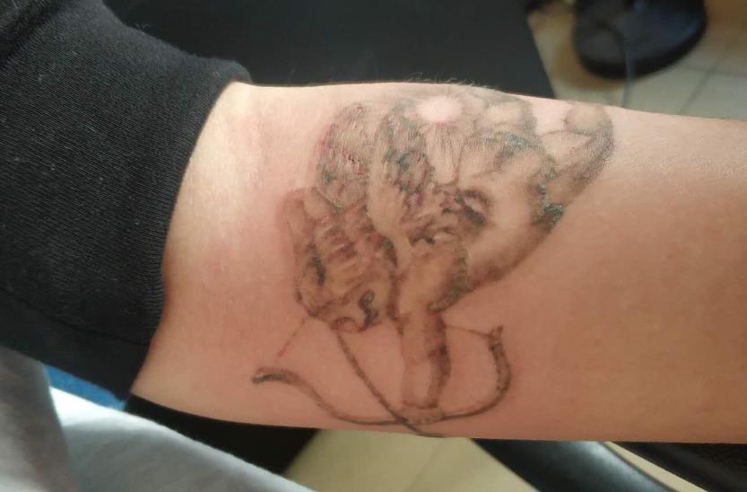 宿遷洗紋身醫(yī)院榮獲六強(qiáng)名單，口碑彰顯實(shí)力！