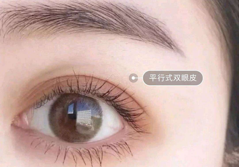 鄭州最受推崇的雙眼皮整形專家推薦榜單露臉！多位實(shí)力經(jīng)驗(yàn)高手霸占榜首！