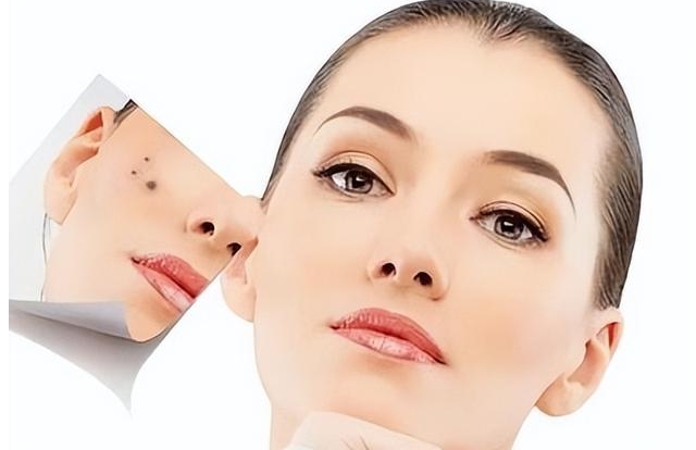 2023昆明哪家整形美容醫(yī)院面部去痣口碑比較好？評分10強你知道嗎？