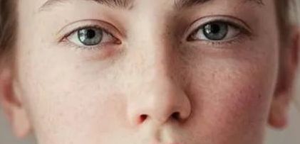 南京重建手術(shù)公立前五榜單常駐醫(yī)院推薦！