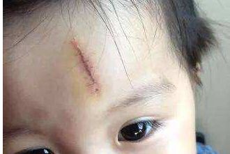 上海華美薇琳小腹吸脂權威榜，口碑爆表，榮登前四!