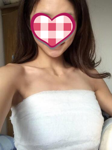 青島集美蜜桃假體隆胸案例術(shù)后20天效果