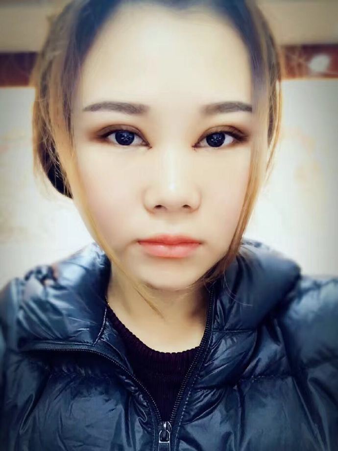 汕頭曙光雙眼皮一周正面