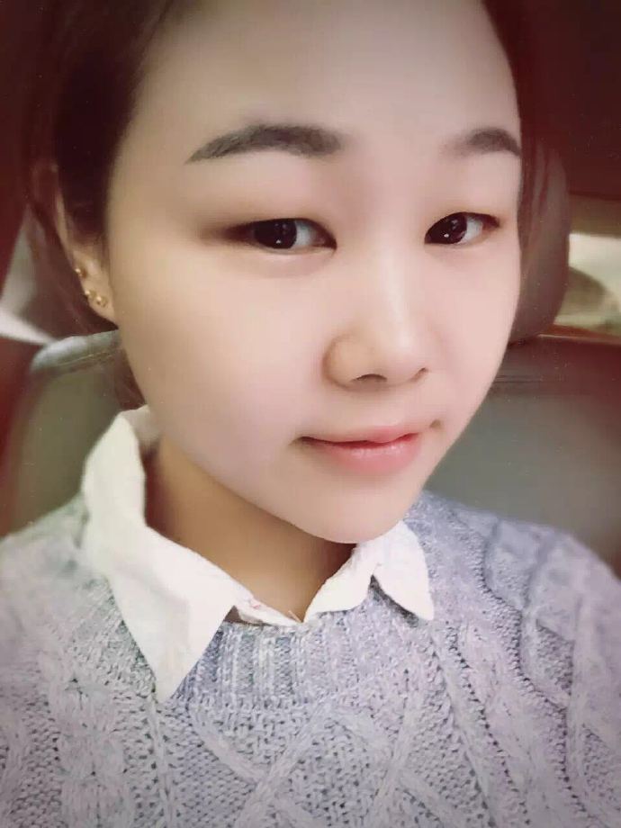 汕頭曙光雙眼皮術(shù)前效果