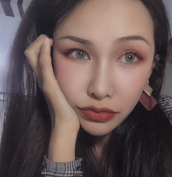 長春中研整形黃帝云鼻頭縮小案例術(shù)后三個月效果