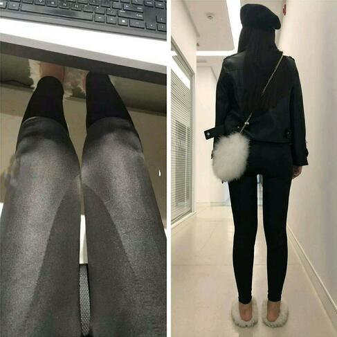 4800做的大腿吸脂，效果竟然還不錯