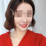 杭州國雅口腔隱形矯正案例分享，有這么好看的牙就要多笑笑