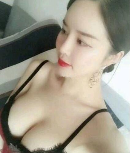 濟南海峽整形假體隆胸術(shù)后一個月 濟南海峽整形假體隆胸術(shù)后一個月