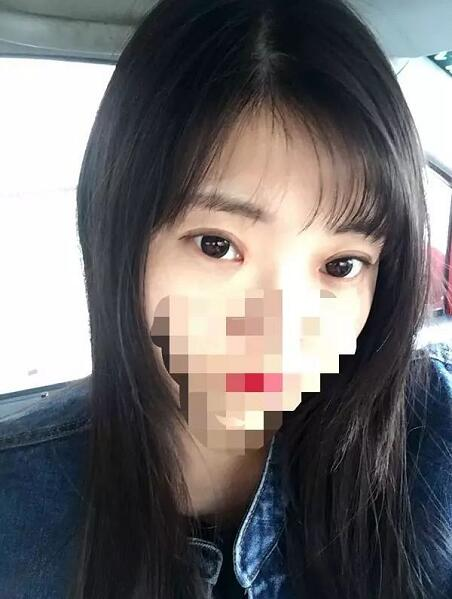 北京京民雙眼皮修復(fù)案例分享，說(shuō)是媽生眼我都信