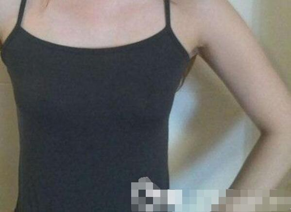 吉安第二醫(yī)院妙桃假體隆胸案例，我一女的都賊喜歡