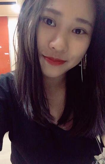 肇慶華美整形切開雙眼皮術后三個月效果分享，這不比貼雙眼皮香？