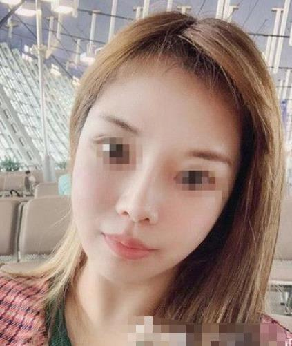 南京閱顏整形瘦臉針案例分享，輕松抗住原相機(jī)